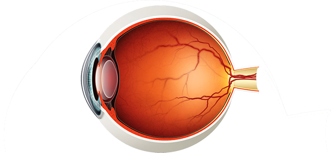 Medical Retina specialist in Hyderabad - Diabetic retinopathy and macular degeneration care