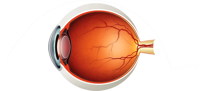 Medical retina treatment in Hyderabad for diabetic retinopathy and macular disease