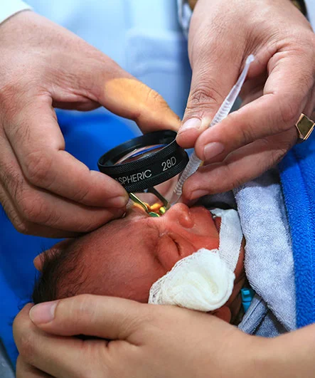 ROP screening in Hyderabad for premature babies