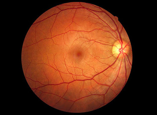 Why Is My Vision Blurry Suddenly? Common Causes You Should Not Ignore