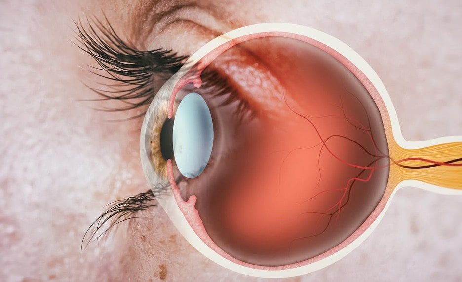 Retinal Detachment: Warning Signs You Should Never Ignore